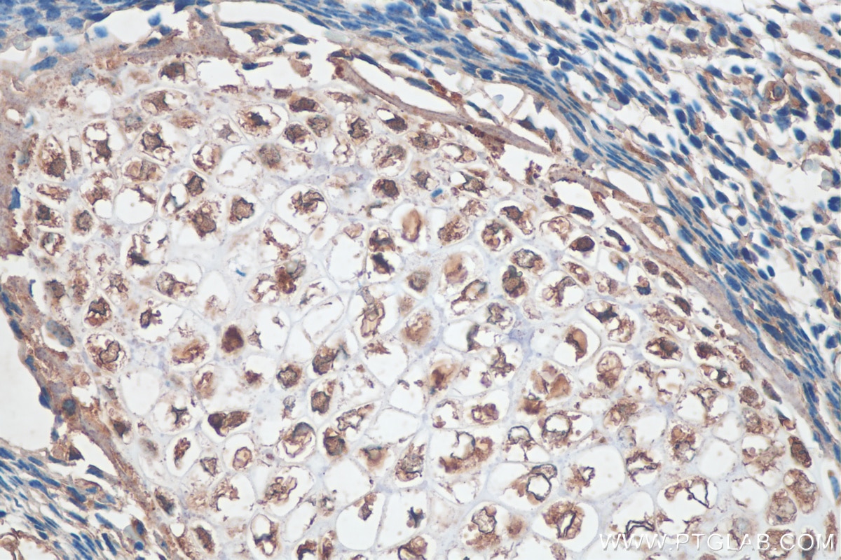 Immunohistochemistry (IHC) staining of mouse embryo tissue using Sclerostin Polyclonal antibody (21933-1-AP)