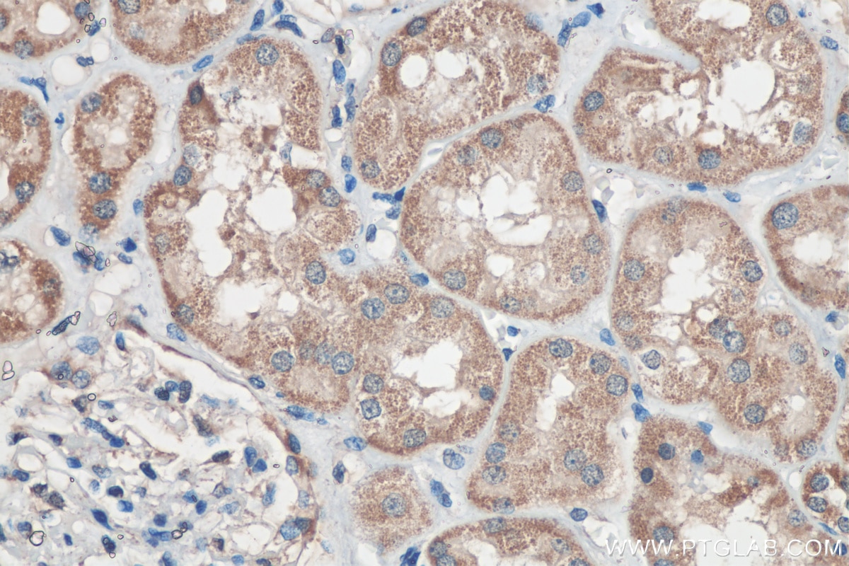Immunohistochemistry (IHC) staining of human kidney tissue using Sclerostin Polyclonal antibody (21933-1-AP)