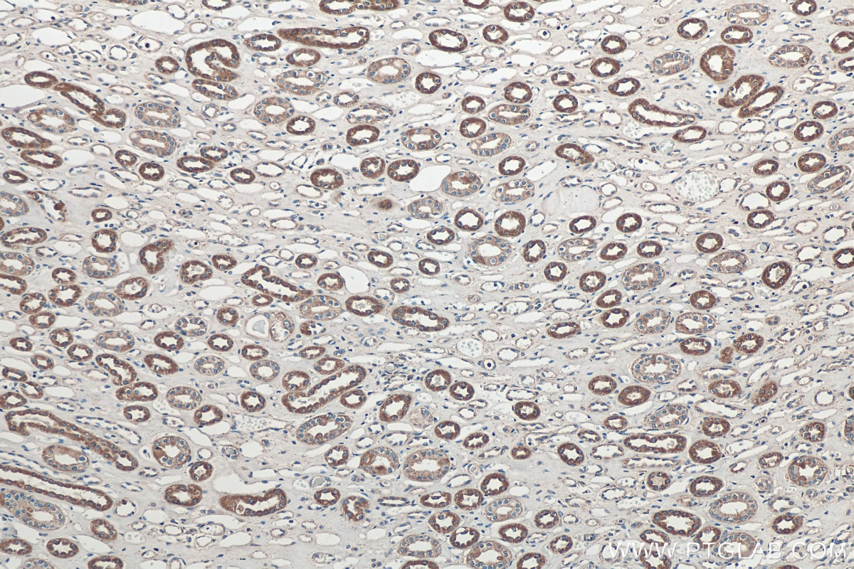 Immunohistochemistry (IHC) staining of human kidney tissue using Sclerostin Polyclonal antibody (21933-1-AP)