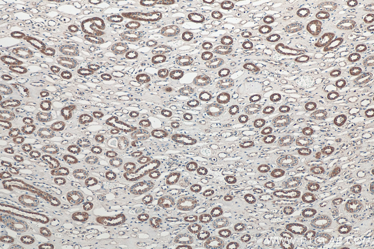Immunohistochemistry (IHC) staining of human kidney tissue using SOST/Sclerostin Polyclonal antibody (21933-1-AP)