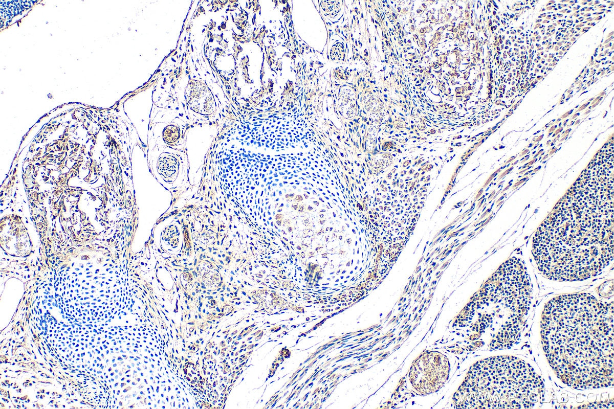 Immunohistochemistry (IHC) staining of mouse embryo tissue using SOST/Sclerostin Polyclonal antibody (21933-1-AP)