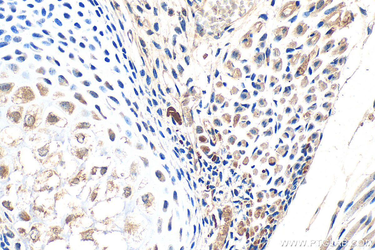 Immunohistochemistry (IHC) staining of mouse embryo tissue using SOST/Sclerostin Polyclonal antibody (21933-1-AP)