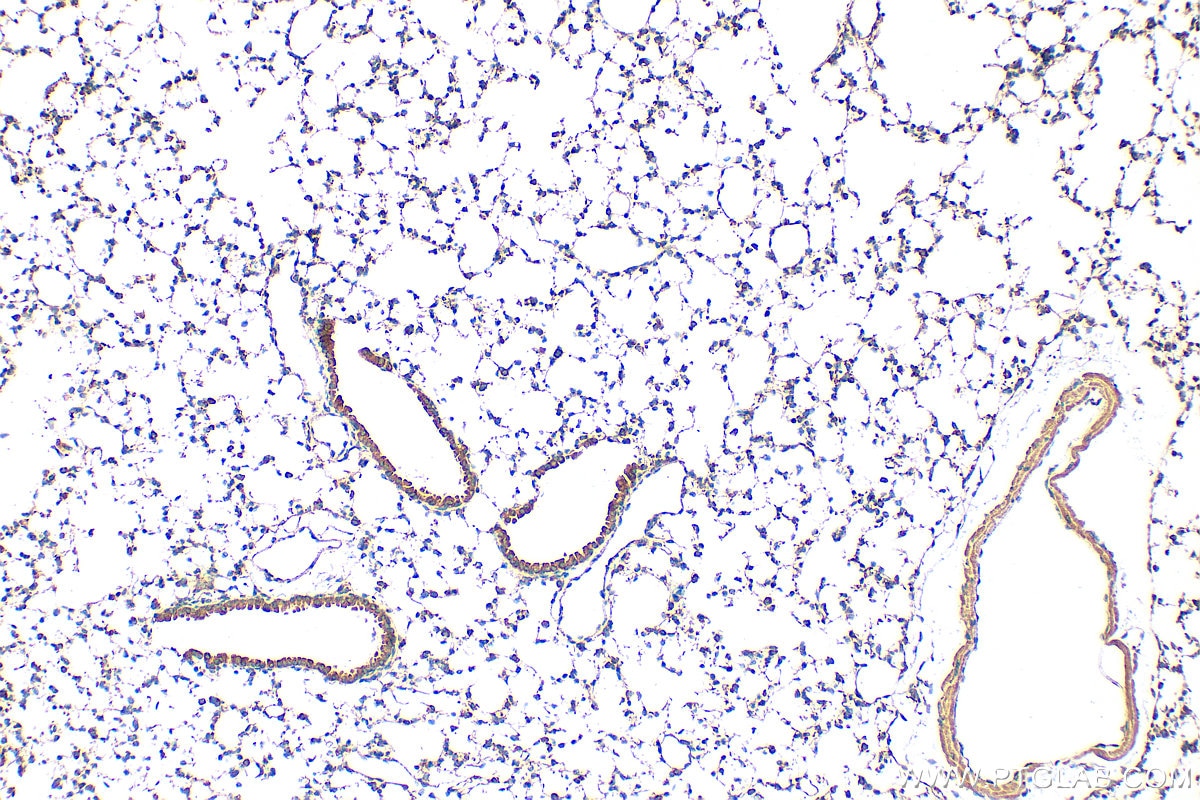 Immunohistochemistry (IHC) staining of mouse lung tissue using SOST/Sclerostin Polyclonal antibody (21933-1-AP)