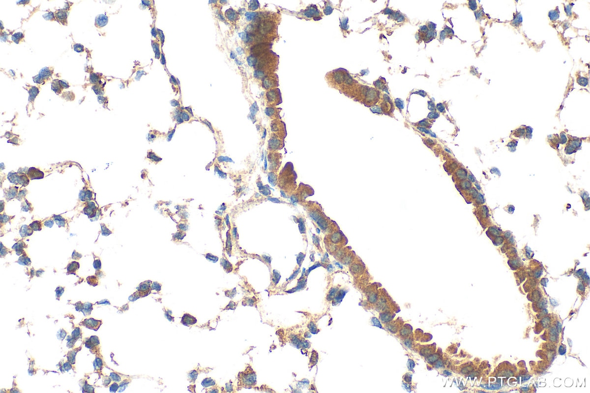 Immunohistochemistry (IHC) staining of mouse lung tissue using SOST/Sclerostin Polyclonal antibody (21933-1-AP)