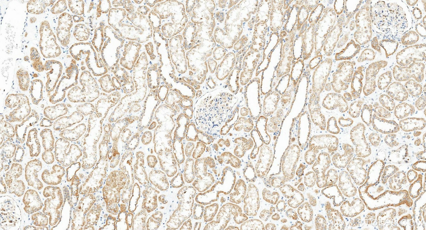 IHC staining of human kidney using 21933-1-AP Immunohistochemistry (IHC) staining of human kidney tissue using SOST/Sclerostin Polyclonal antibody (21933-1-AP)