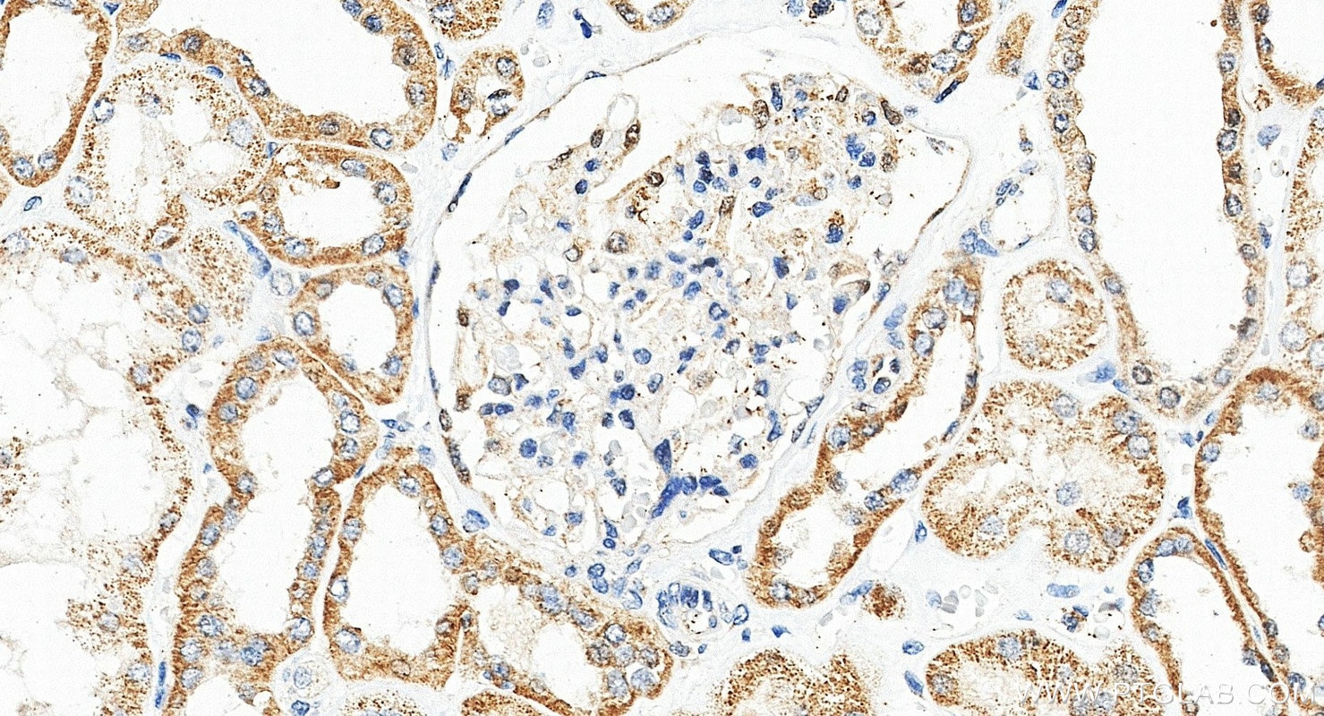 IHC staining of human kidney using 21933-1-AP Immunohistochemistry (IHC) staining of human kidney tissue using SOST/Sclerostin Polyclonal antibody (21933-1-AP)