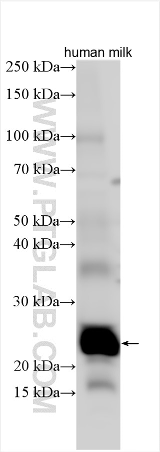 Western Blot (WB) analysis of various lysates using SOSTDC1 Polyclonal antibody (22213-1-AP)