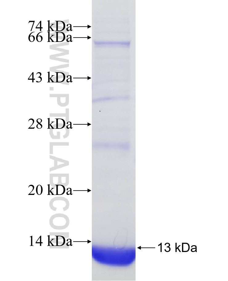 SOX1 fusion protein Ag31118 SDS-PAGE