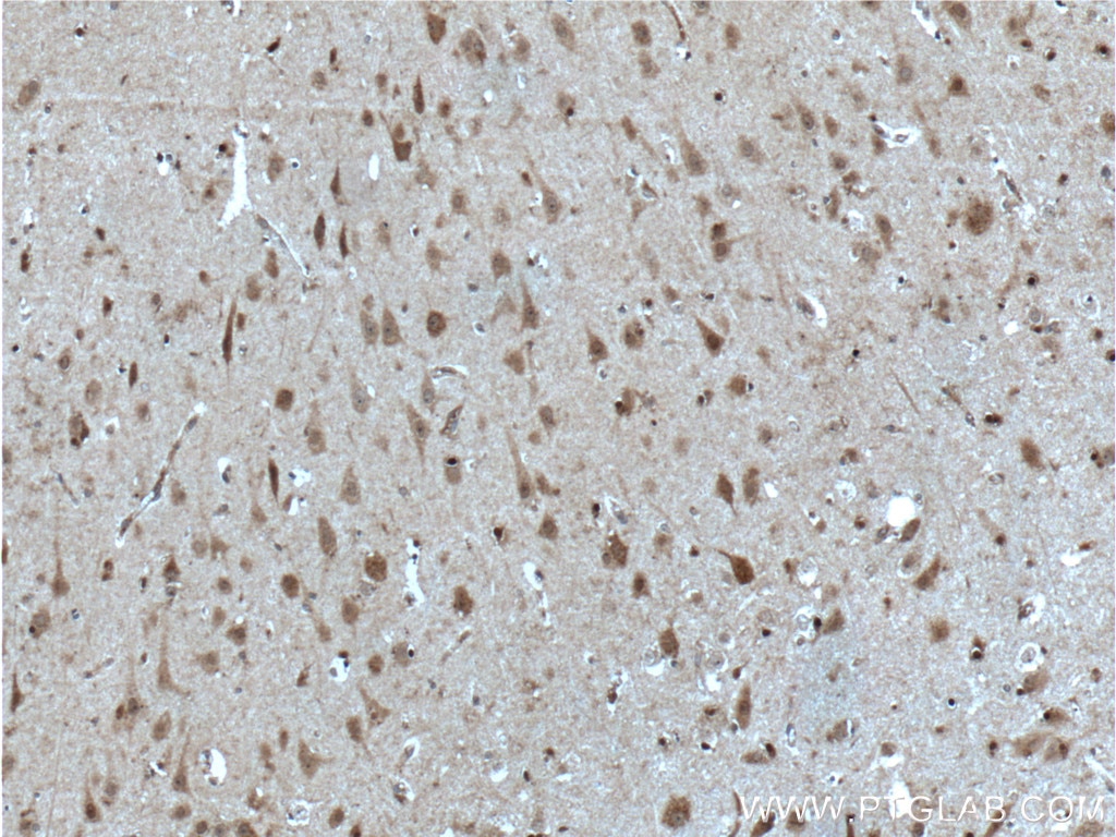 Immunohistochemistry (IHC) staining of human brain tissue using SOX10 Polyclonal antibody (10422-1-AP)