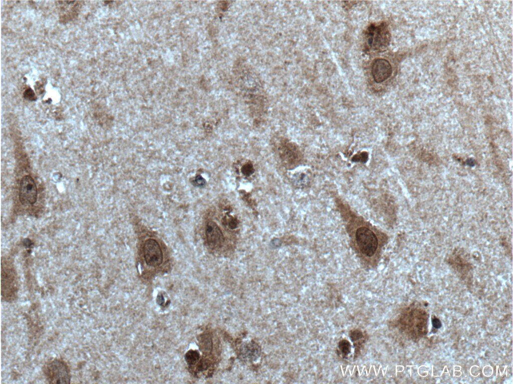 Immunohistochemistry (IHC) staining of human brain tissue using SOX10 Polyclonal antibody (10422-1-AP)