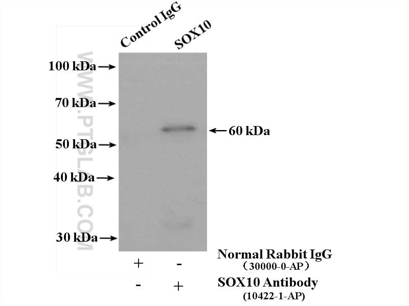 Immunoprecipitation (IP) experiment of mouse colon tissue using SOX10 Polyclonal antibody (10422-1-AP)