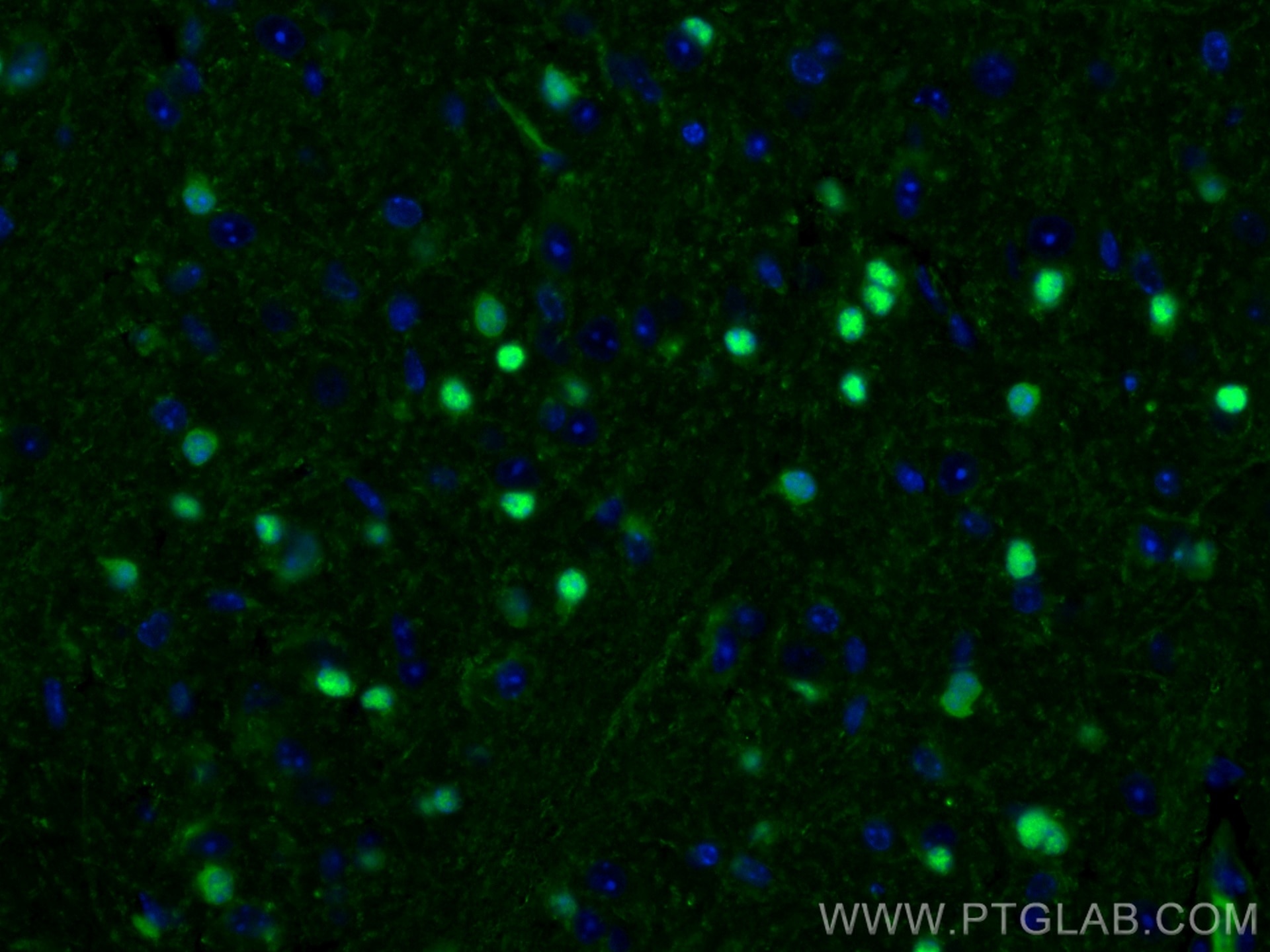 Immunofluorescence (IF) / fluorescent staining of mouse brain tissue using SOX10 Monoclonal antibody (66786-1-Ig)
