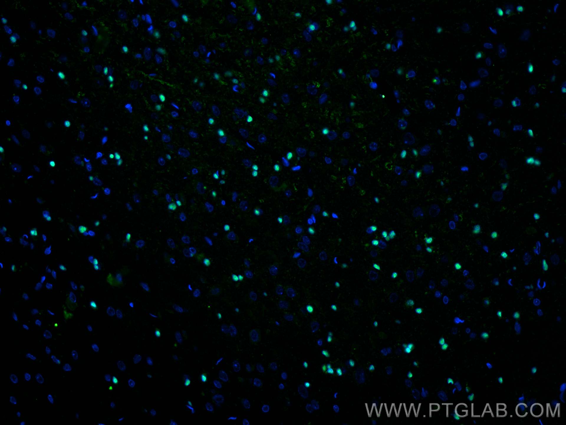 Immunofluorescence (IF) / fluorescent staining of rat brain tissue using SOX10 Monoclonal antibody (66786-1-Ig)