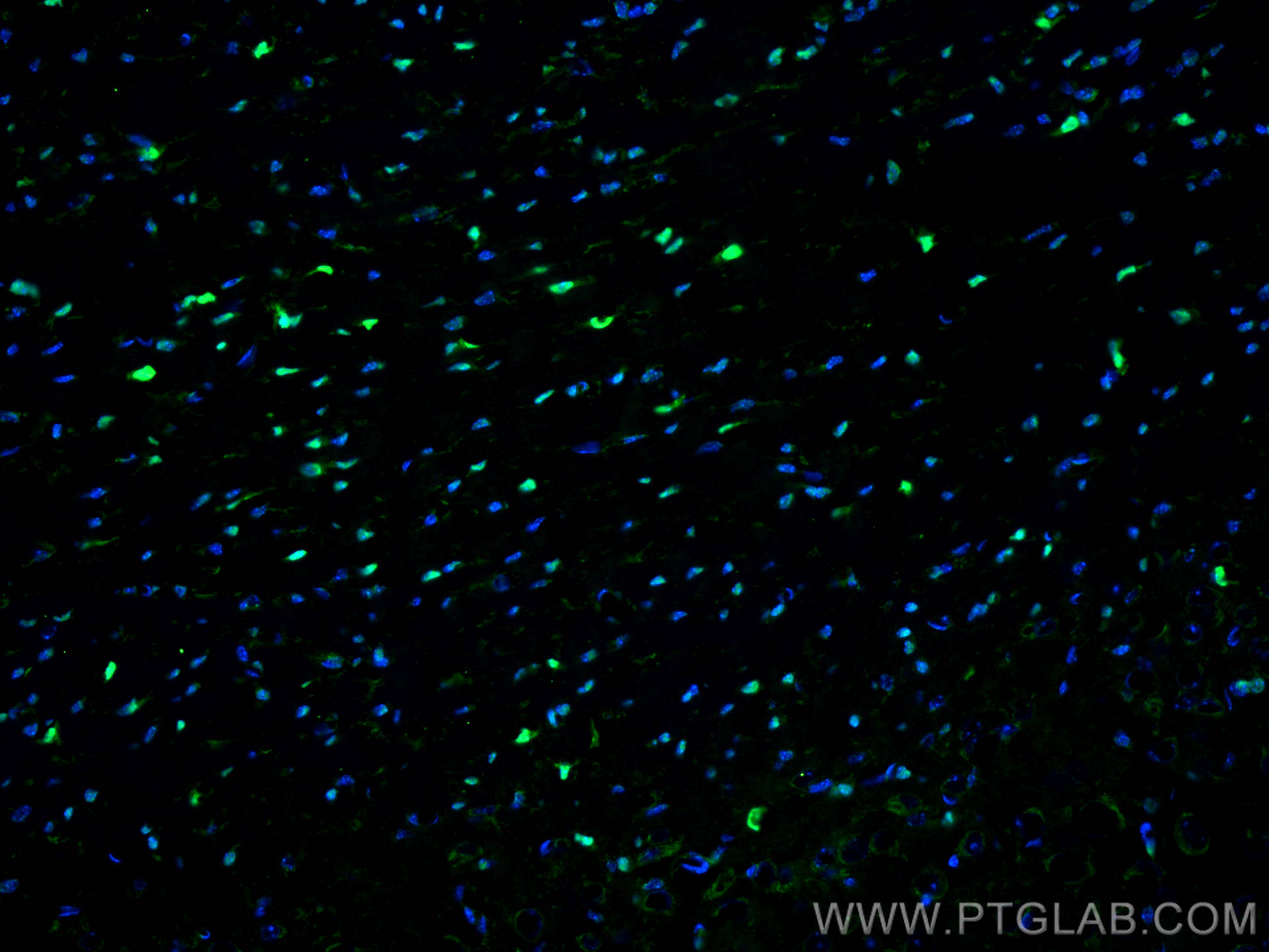 Immunofluorescence (IF) / fluorescent staining of mouse brain tissue using SOX10 Monoclonal antibody (66786-1-Ig)