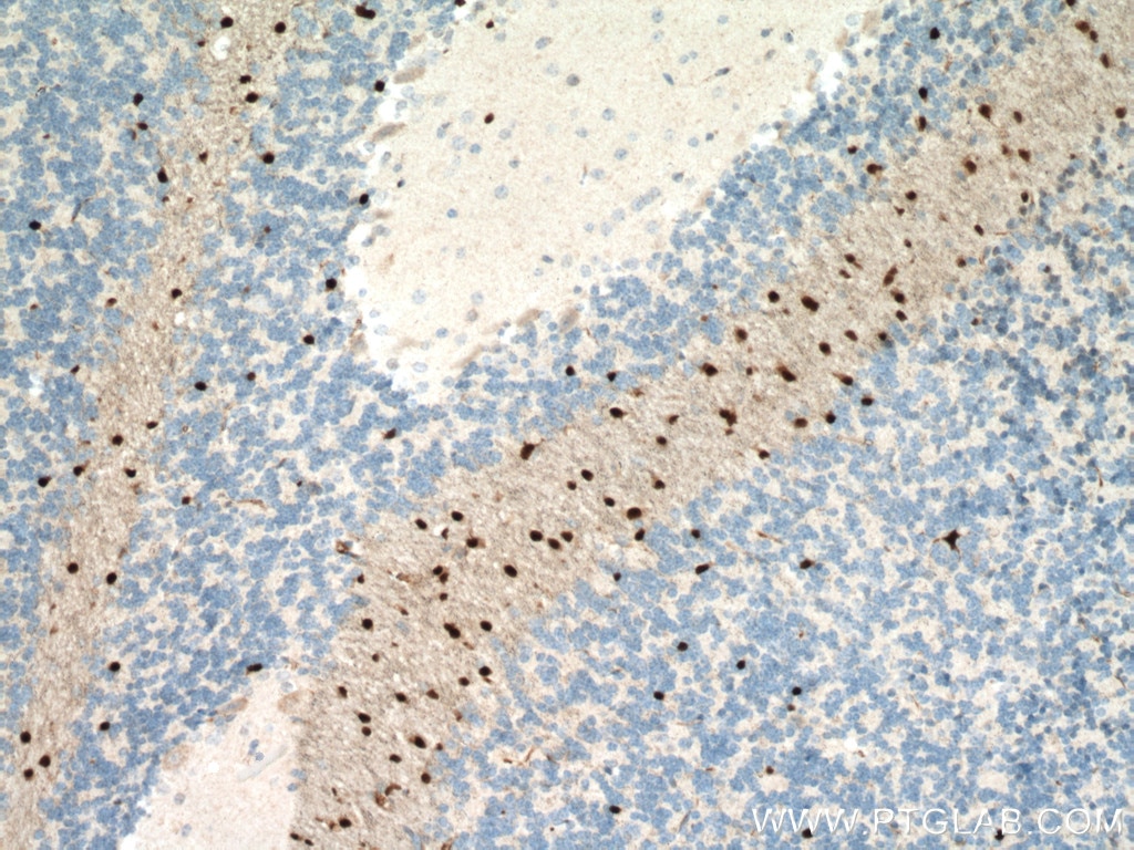 Immunohistochemistry (IHC) staining of mouse brain tissue using SOX10 Monoclonal antibody (66786-1-Ig)