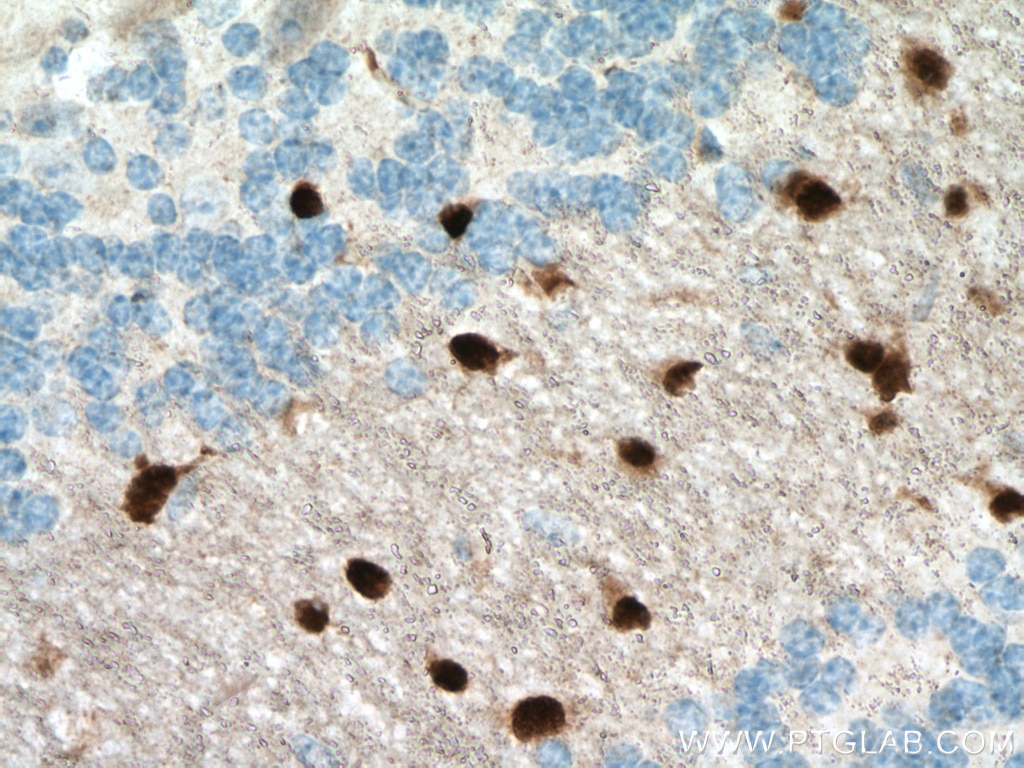 Immunohistochemistry (IHC) staining of mouse brain tissue using SOX10 Monoclonal antibody (66786-1-Ig)