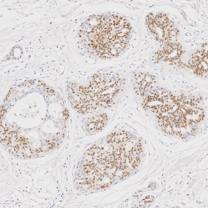 Immunohistochemistry (IHC) staining of human breast tissue using SOX10 Monoclonal antibody (66786-1-Ig)