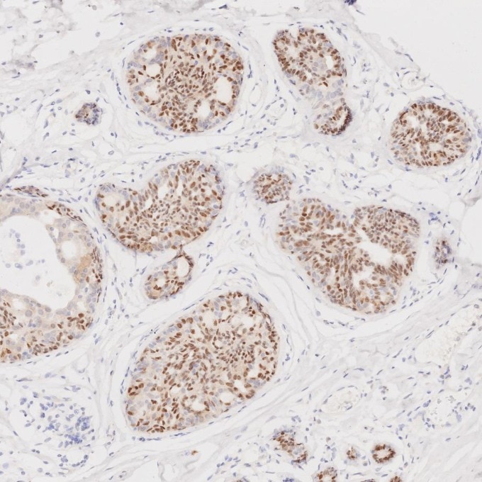Immunohistochemistry (IHC) staining of human breast tissue using SOX10 Monoclonal antibody (66786-1-Ig)