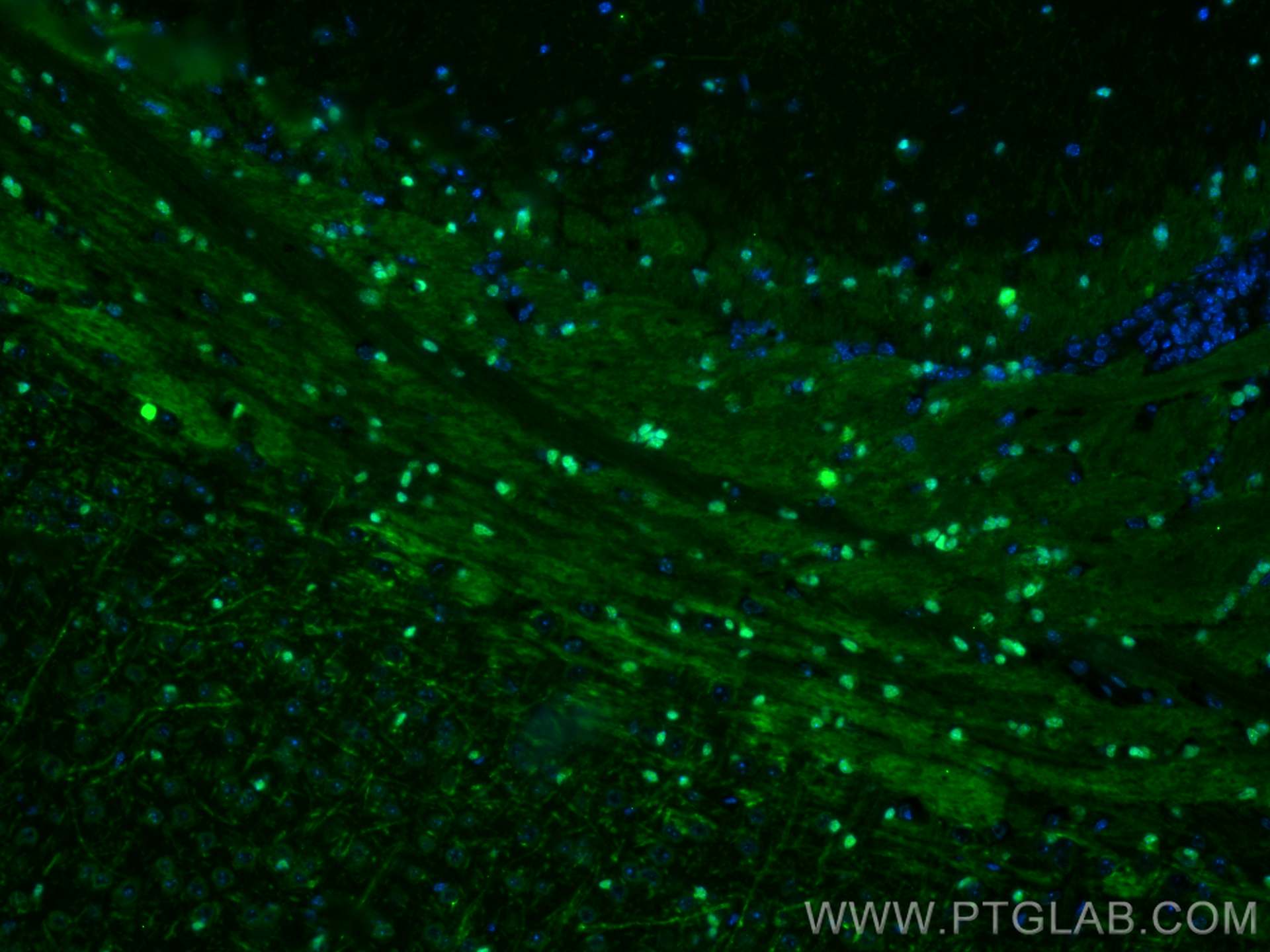Immunofluorescence (IF) / fluorescent staining of mouse brain tissue using CoraLite® Plus 488-conjugated SOX10 Monoclonal ant (CL488-66786)
