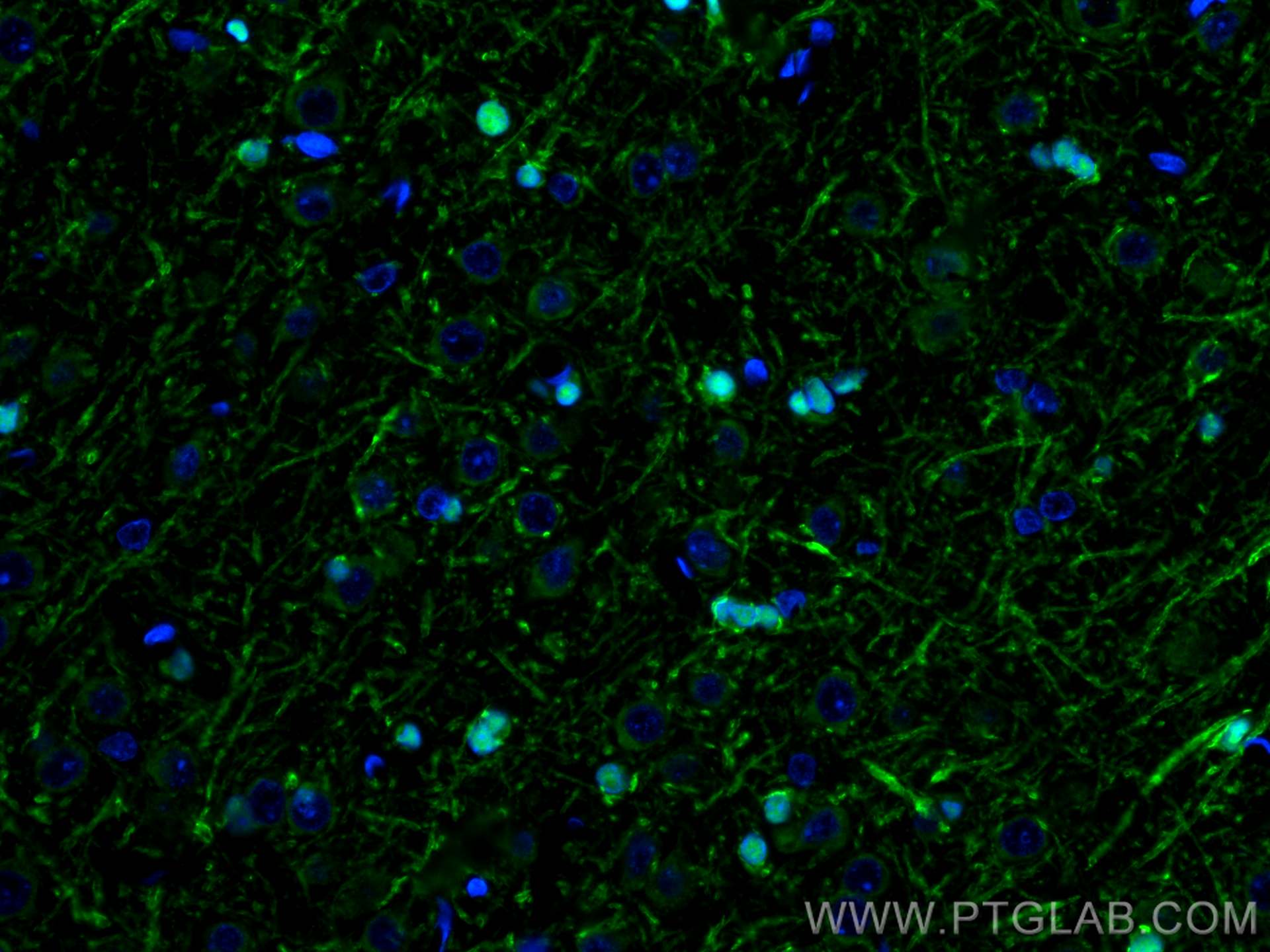 Immunofluorescence (IF) / fluorescent staining of rat brain tissue using CoraLite® Plus 488-conjugated SOX10 Monoclonal ant (CL488-66786)