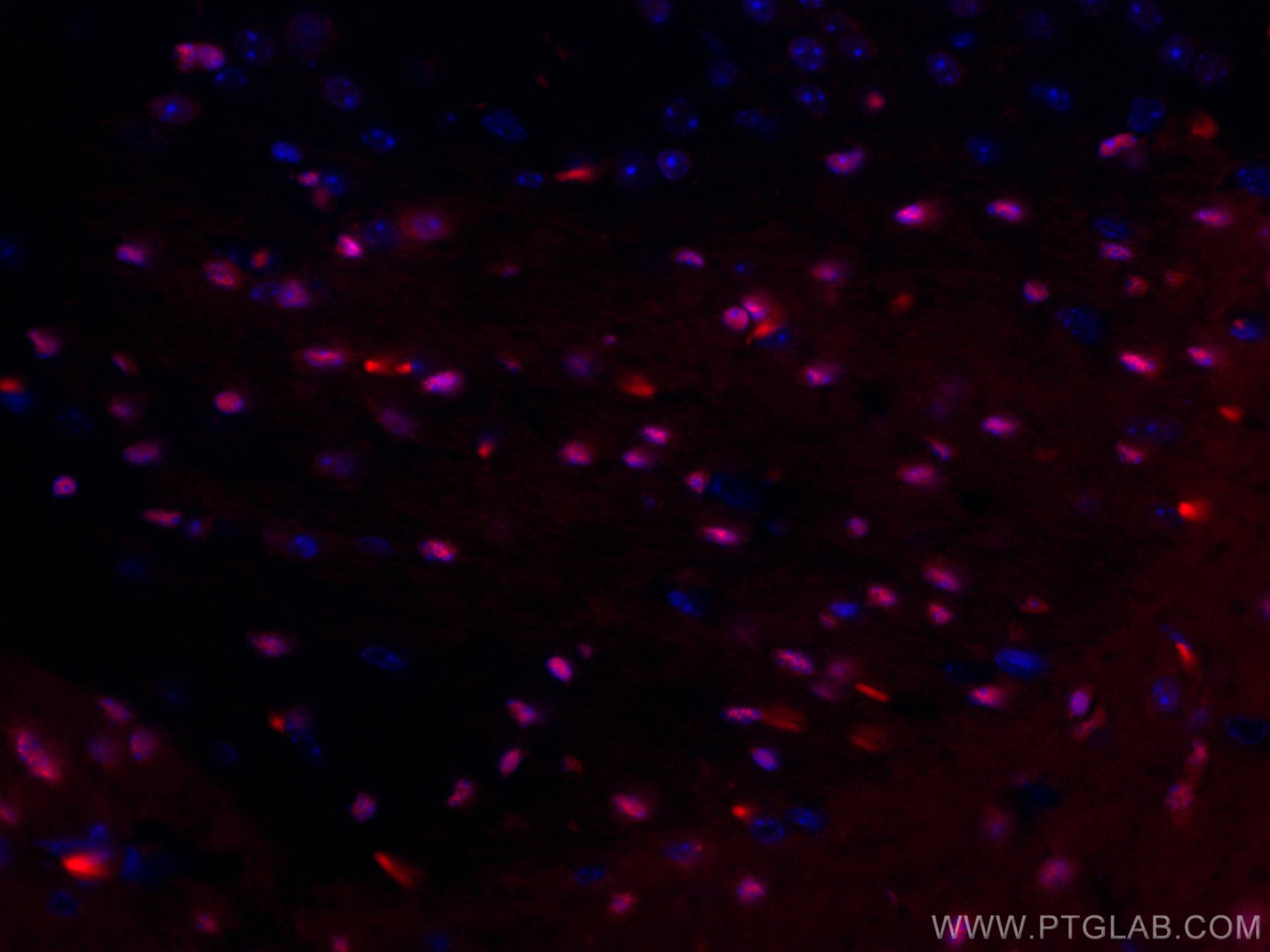 IF Staining of mouse brain using CL594-66786