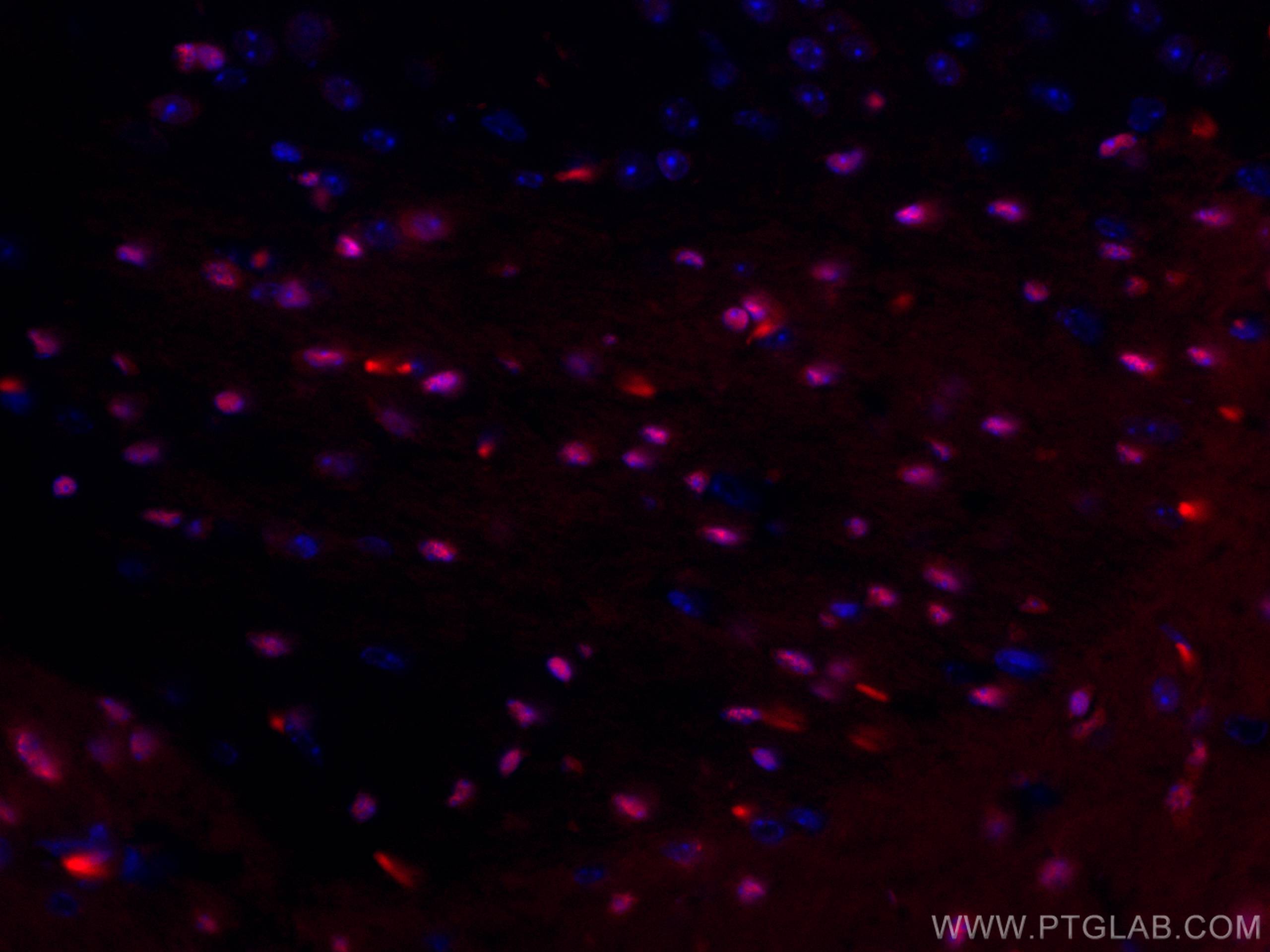 Immunofluorescence (IF) / fluorescent staining of mouse brain tissue using CoraLite®594-conjugated SOX10 Monoclonal antibody (CL594-66786)