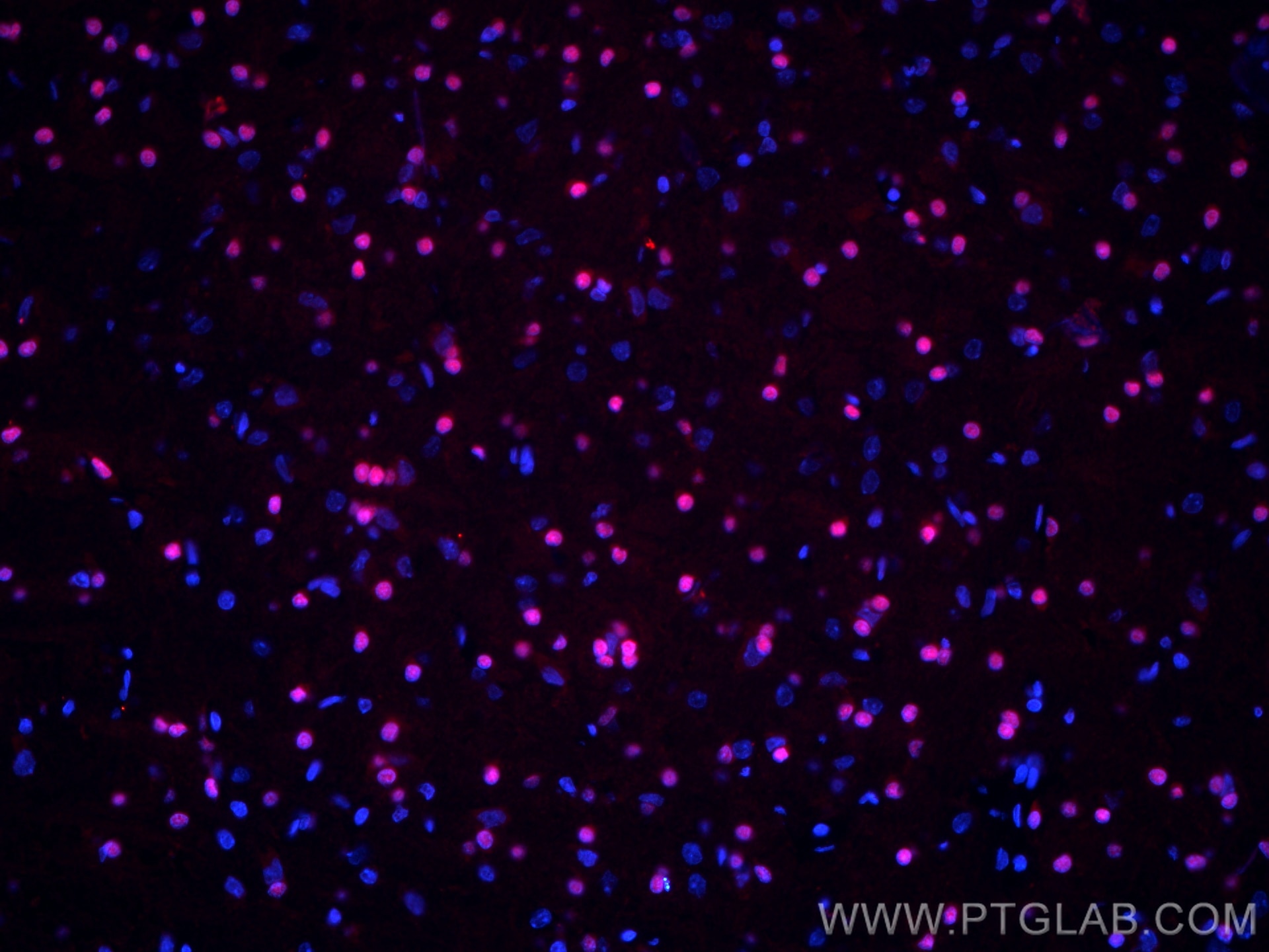 IF Staining of rat brain using CL594-66786