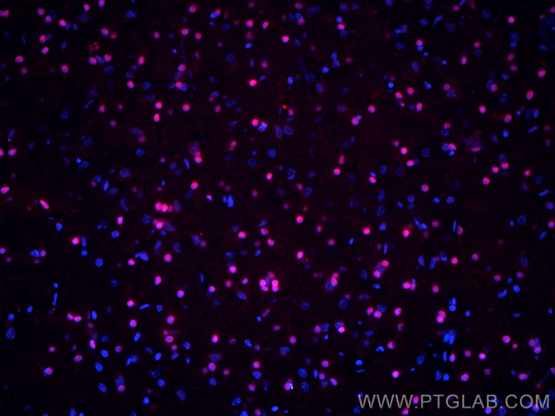 Immunofluorescence (IF) / fluorescent staining of rat brain tissue using CoraLite®594-conjugated SOX10 Monoclonal antibody (CL594-66786)