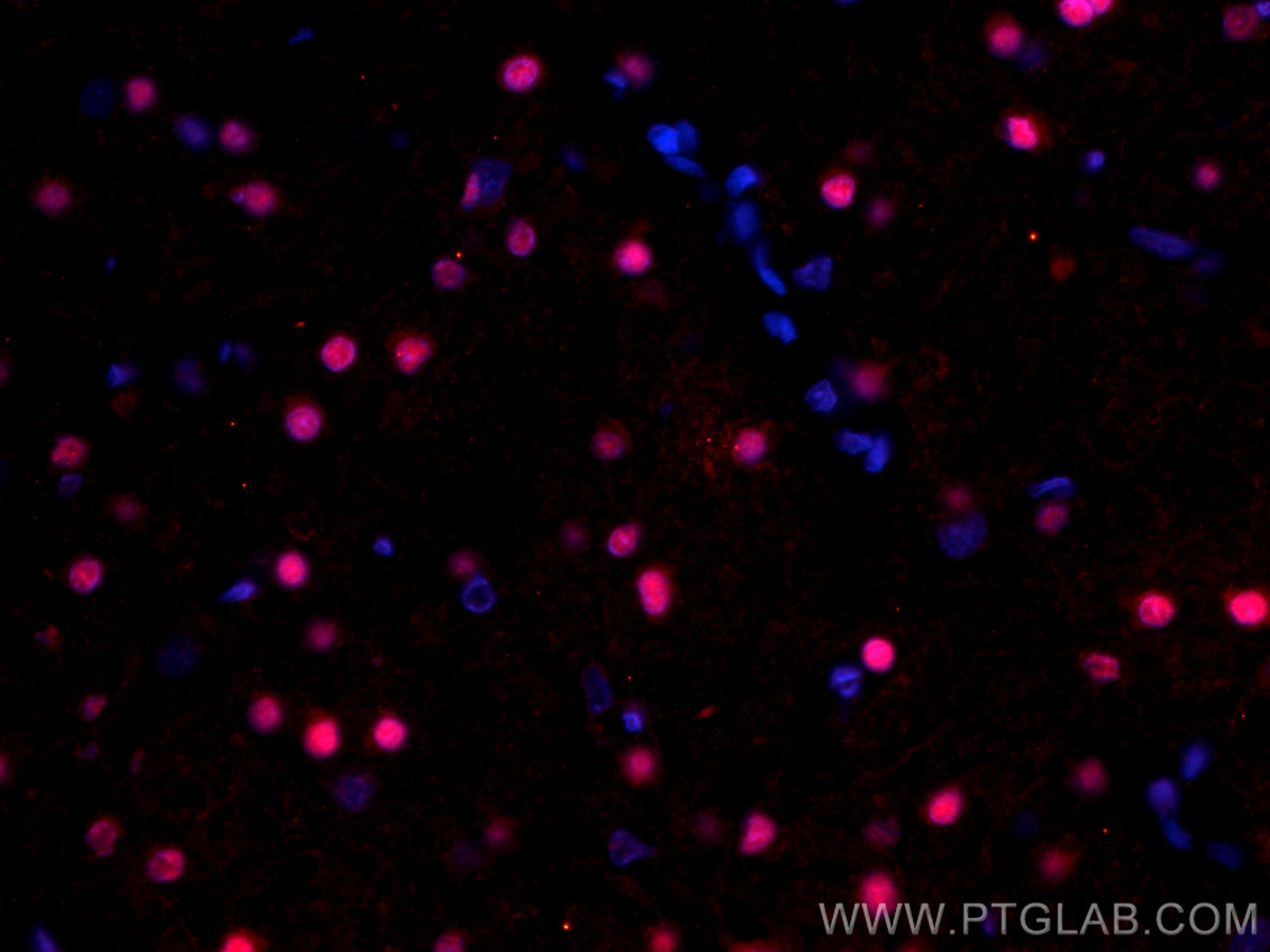 Immunofluorescence (IF) / fluorescent staining of rat brain tissue using CoraLite®594-conjugated SOX10 Monoclonal antibody (CL594-66786)