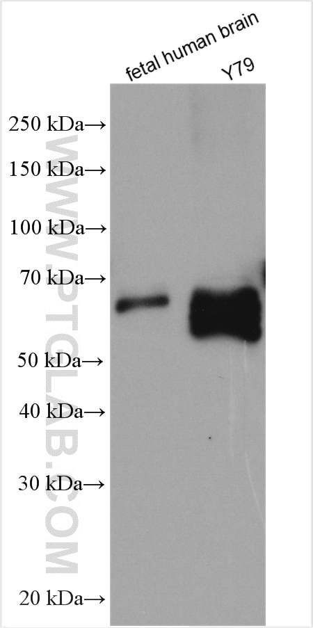 Western Blot (WB) analysis of various lysates using SOX11 Polyclonal antibody (29395-1-AP)
