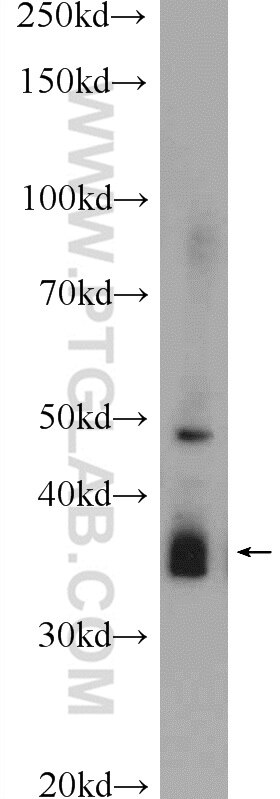 Western Blot (WB) analysis of mouse brain tissue using SOX12 Polyclonal antibody (23939-1-AP)