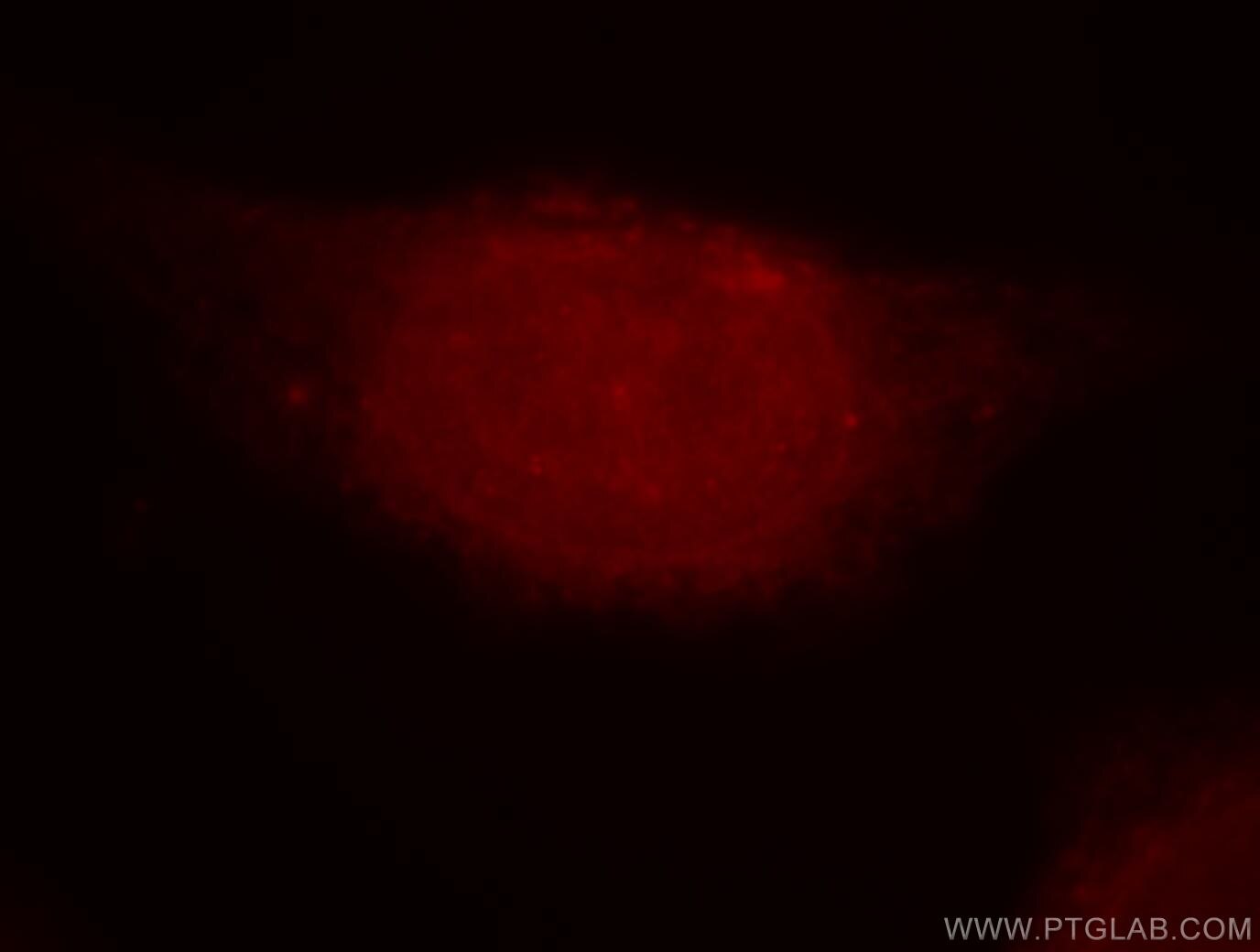 Immunofluorescence (IF) / fluorescent staining of HeLa cells using SOX13 Polyclonal antibody (18902-1-AP)