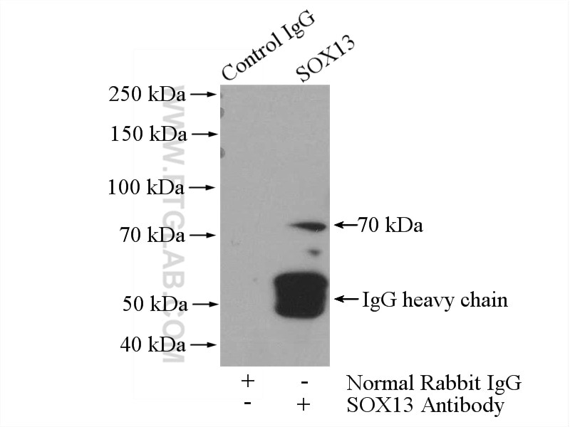 Immunoprecipitation (IP) experiment of SH-SY5Y cells using SOX13 Polyclonal antibody (18902-1-AP)