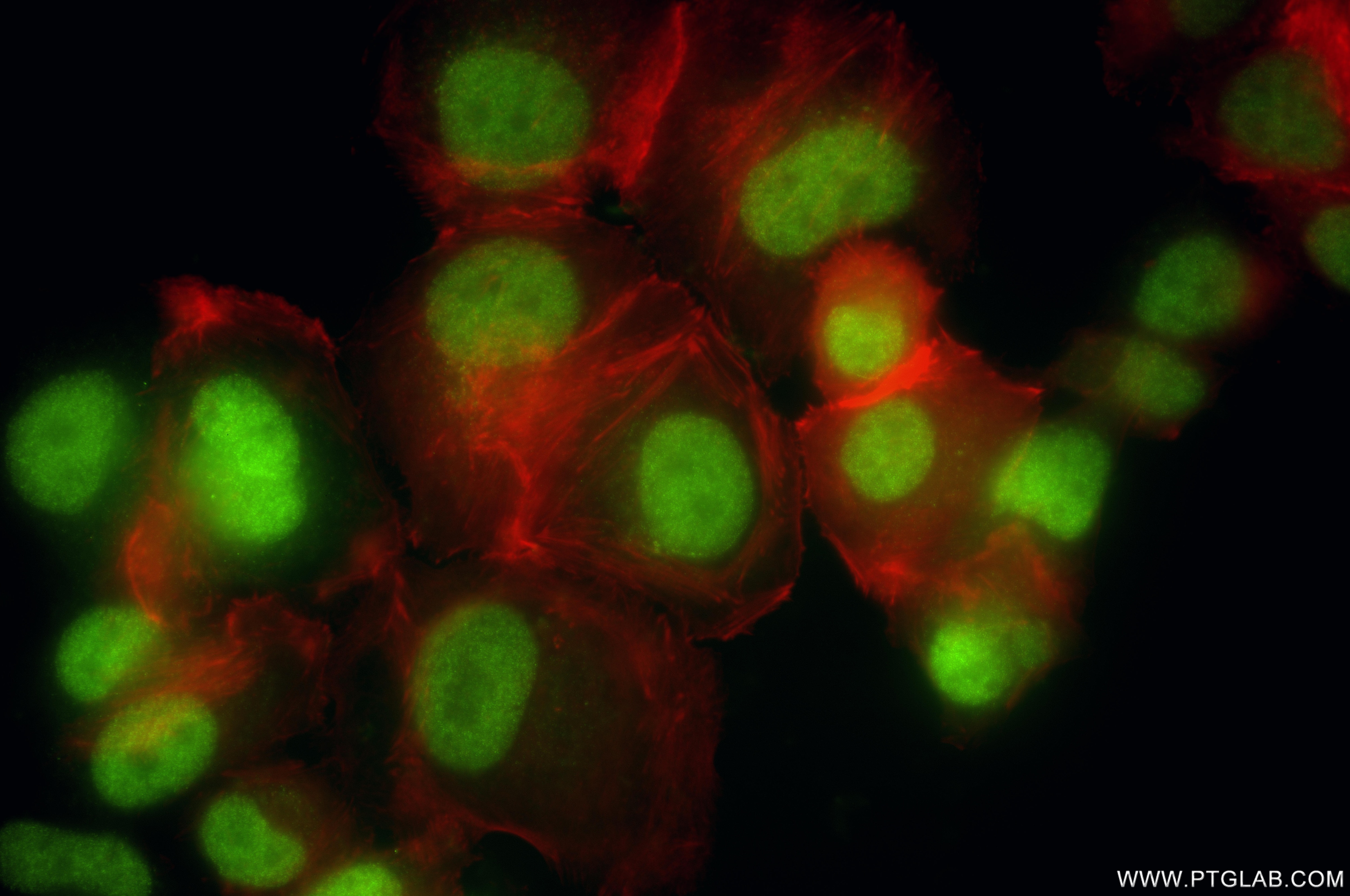 Immunofluorescence (IF) / fluorescent staining of SK-BR-3 cells using SOX13 Recombinant monoclonal antibody (86184-1-RR)