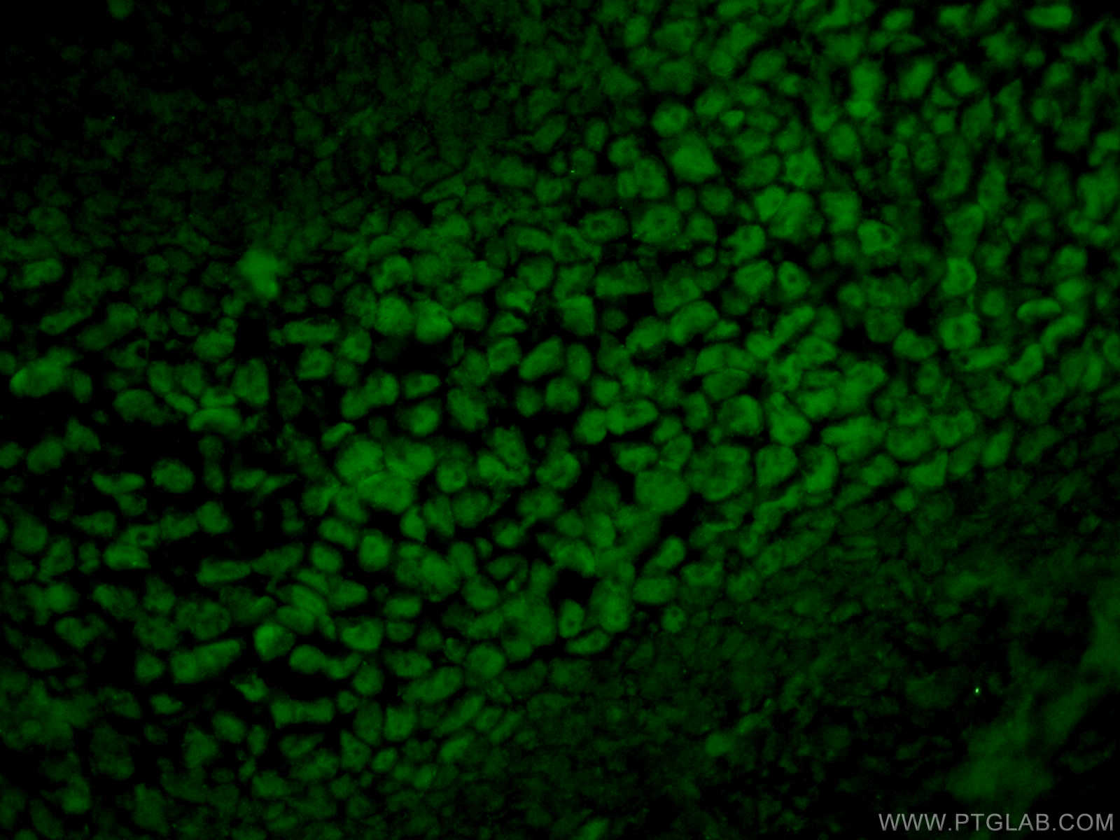 Immunofluorescence (IF) / fluorescent staining of mouse embryo tissue using SOX15 Polyclonal antibody (16725-1-AP)