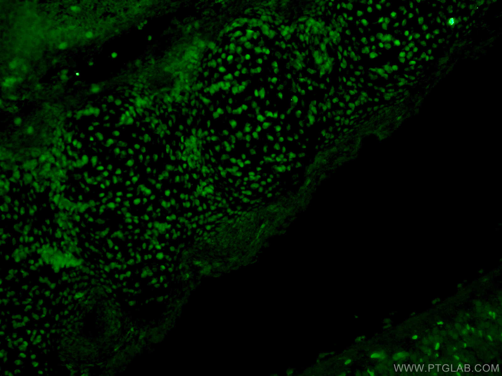 Immunofluorescence (IF) / fluorescent staining of mouse embryo tissue using SOX15 Polyclonal antibody (16725-1-AP)
