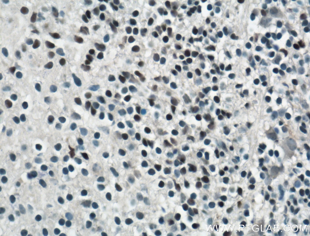 Immunohistochemistry (IHC) staining of mouse embryo tissue using SOX15 Polyclonal antibody (16725-1-AP)