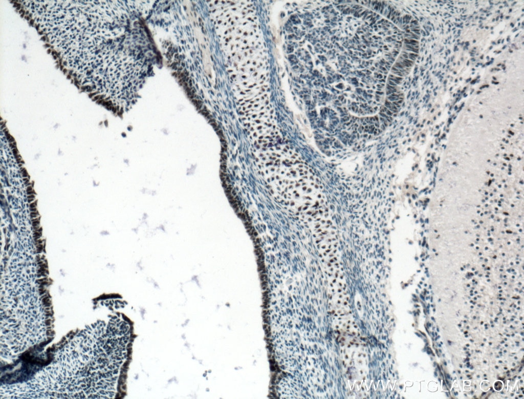 Immunohistochemistry (IHC) staining of mouse embryo tissue using SOX15 Polyclonal antibody (16725-1-AP)