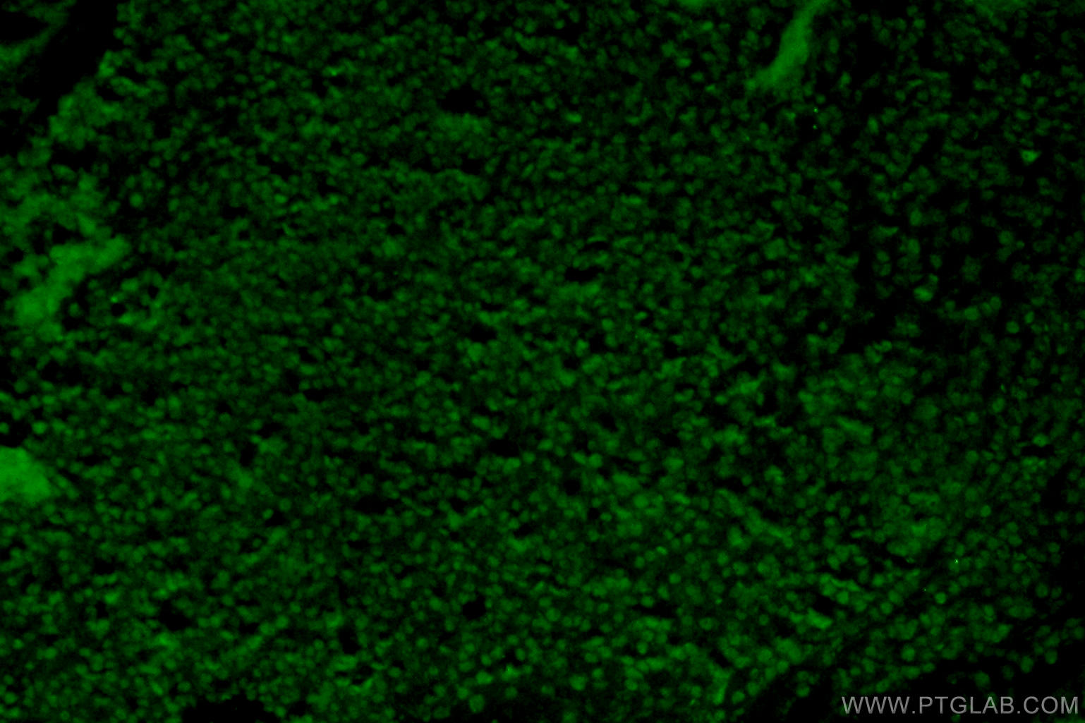 Immunofluorescence (IF) / fluorescent staining of mouse embryo tissue using SOX15 Polyclonal antibody (25415-1-AP)
