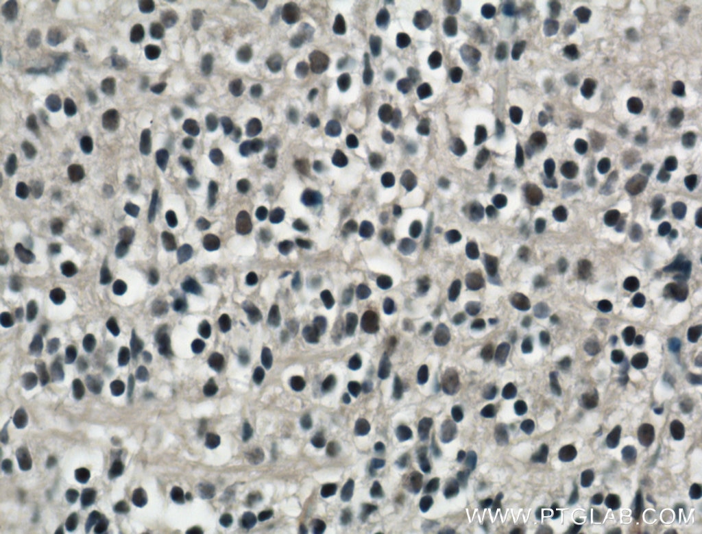 Immunohistochemistry (IHC) staining of mouse embryo tissue using SOX15 Polyclonal antibody (25415-1-AP)