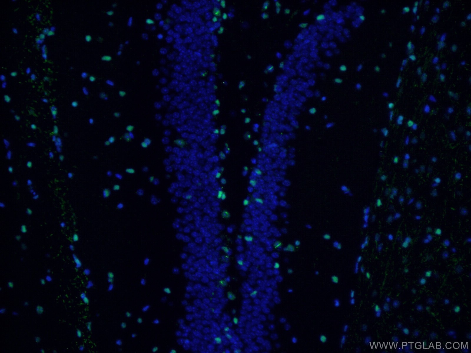 Immunofluorescence (IF) / fluorescent staining of mouse brain tissue using SOX2 Polyclonal antibody (11064-1-AP)