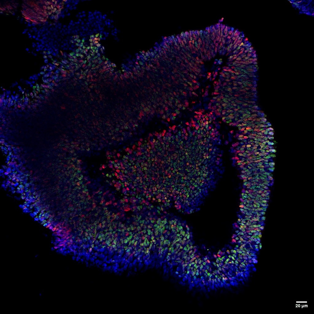 Immunofluorescence (IF) / fluorescent staining of Retinal organoids using SOX2 Polyclonal antibody (11064-1-AP)