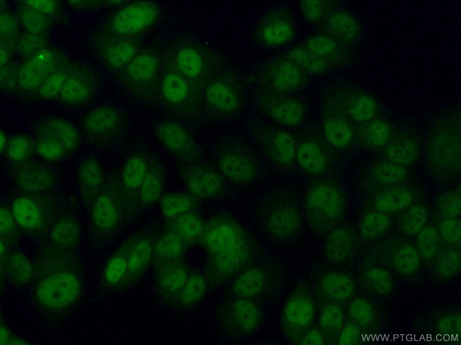 Immunofluorescence (IF) / fluorescent staining of NCCIT cells using SOX2 Polyclonal antibody (11064-1-AP)