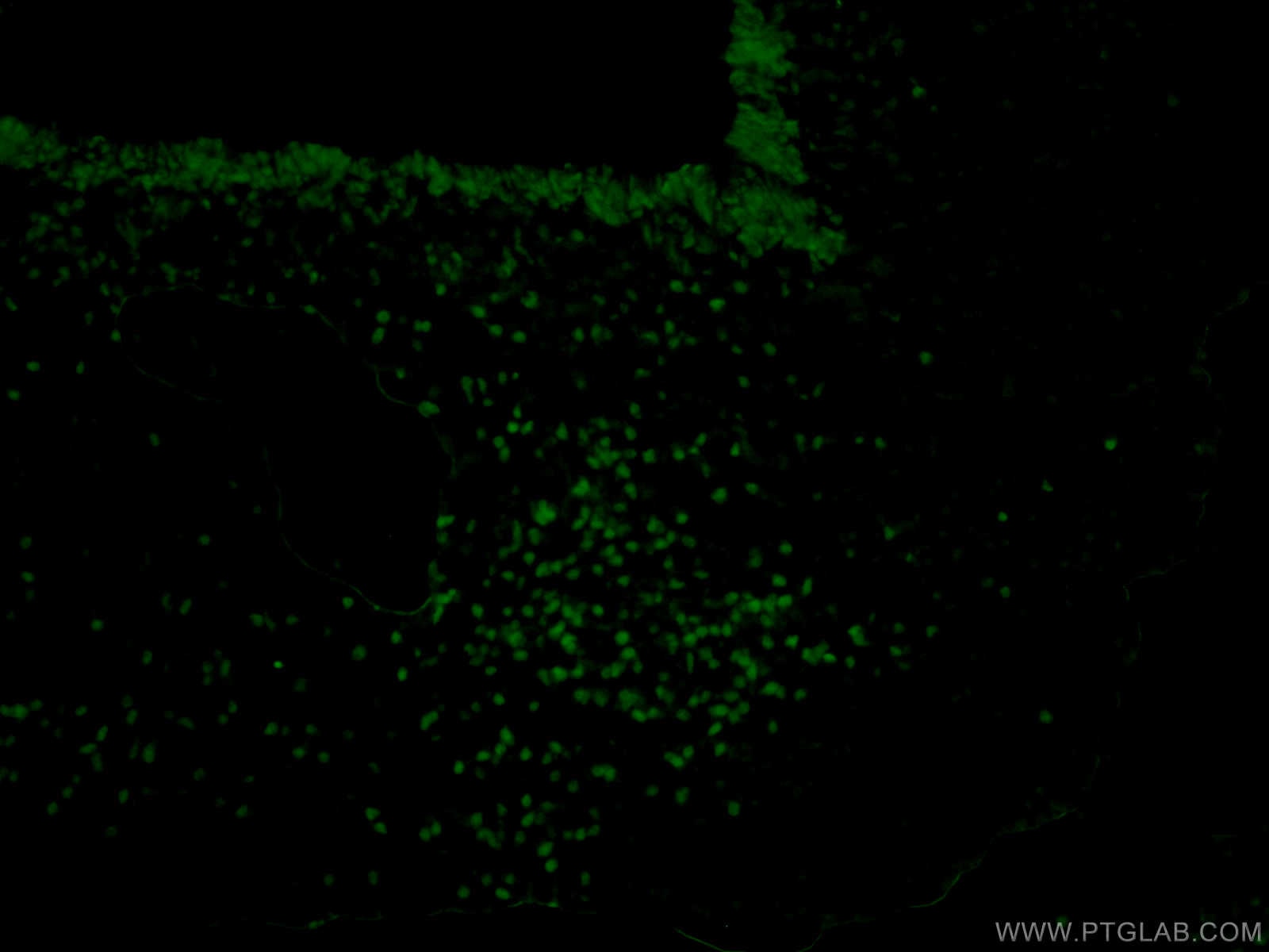 Immunofluorescence (IF) / fluorescent staining of mouse embryo tissue using SOX2 Polyclonal antibody (11064-1-AP)
