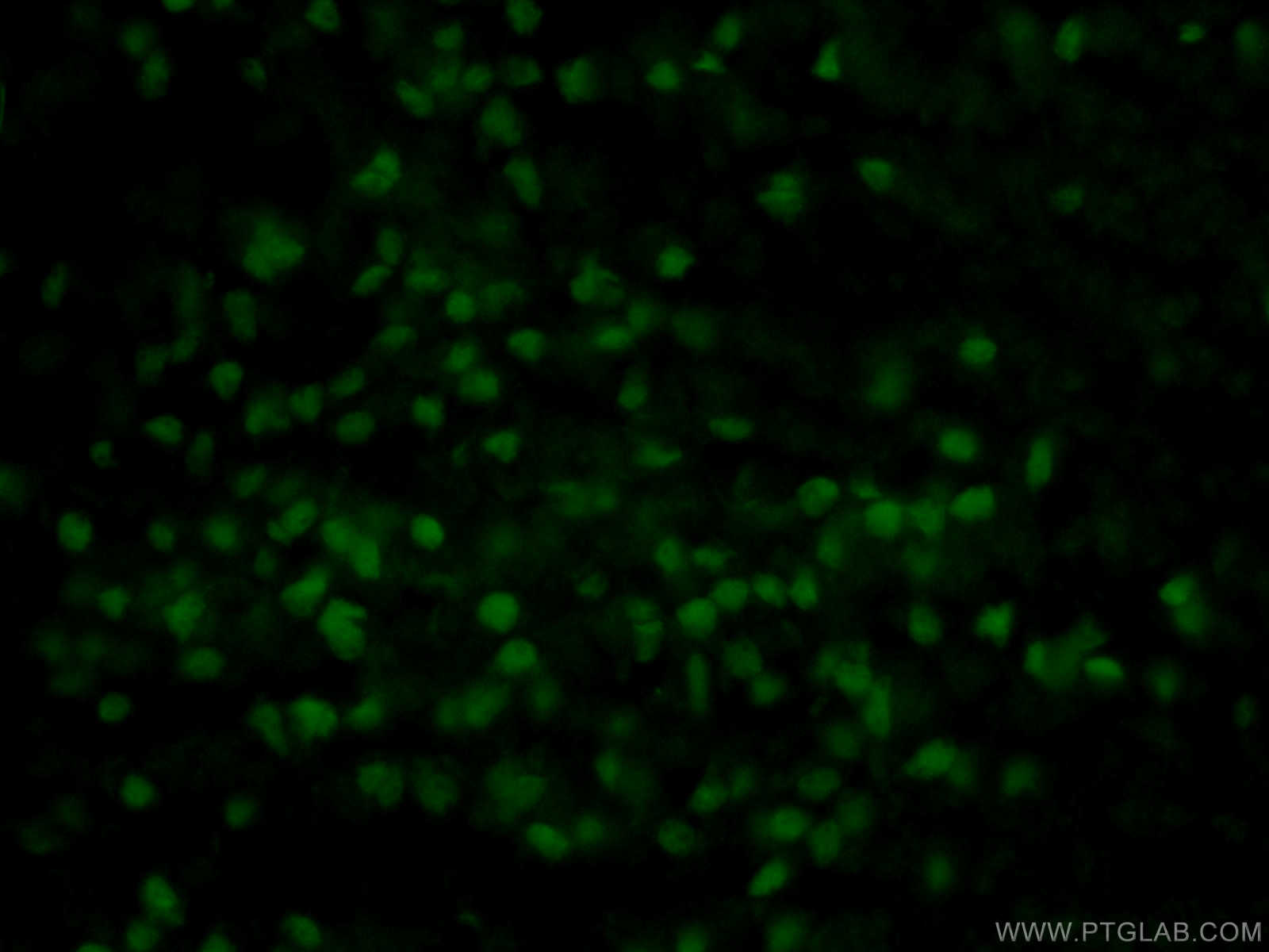 Immunofluorescence (IF) / fluorescent staining of mouse embryo tissue using SOX2 Polyclonal antibody (11064-1-AP)