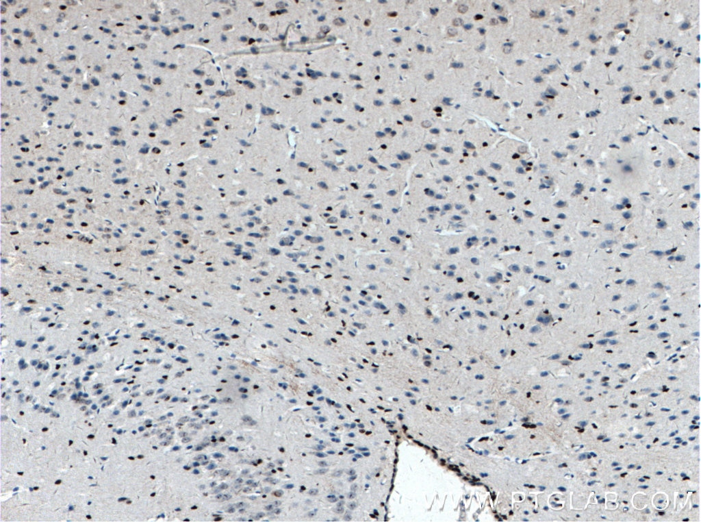 Immunohistochemistry (IHC) staining of mouse brain tissue using SOX2 Polyclonal antibody (11064-1-AP)