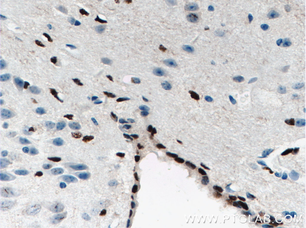 IHC staining of mouse brain using 11064-1-AP