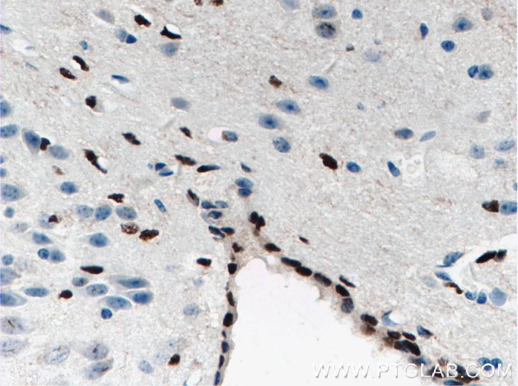 Immunohistochemistry (IHC) staining of mouse brain tissue using SOX2 Polyclonal antibody (11064-1-AP)