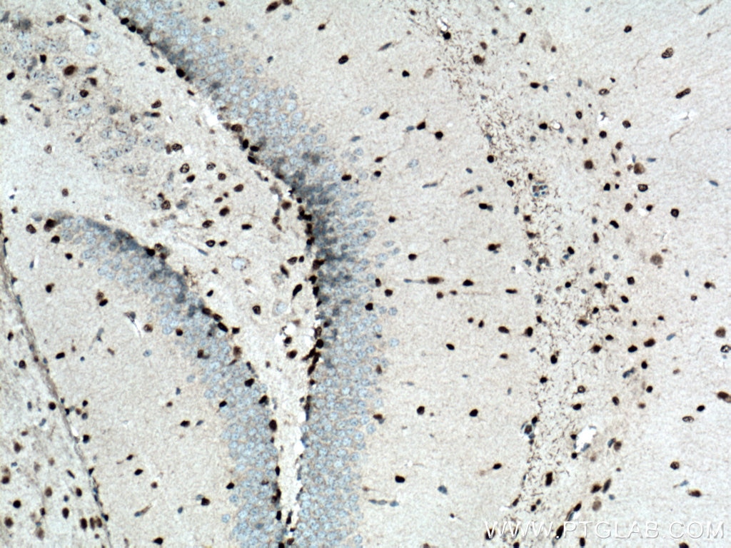 Immunohistochemistry (IHC) staining of mouse brain tissue using SOX2 Polyclonal antibody (11064-1-AP)