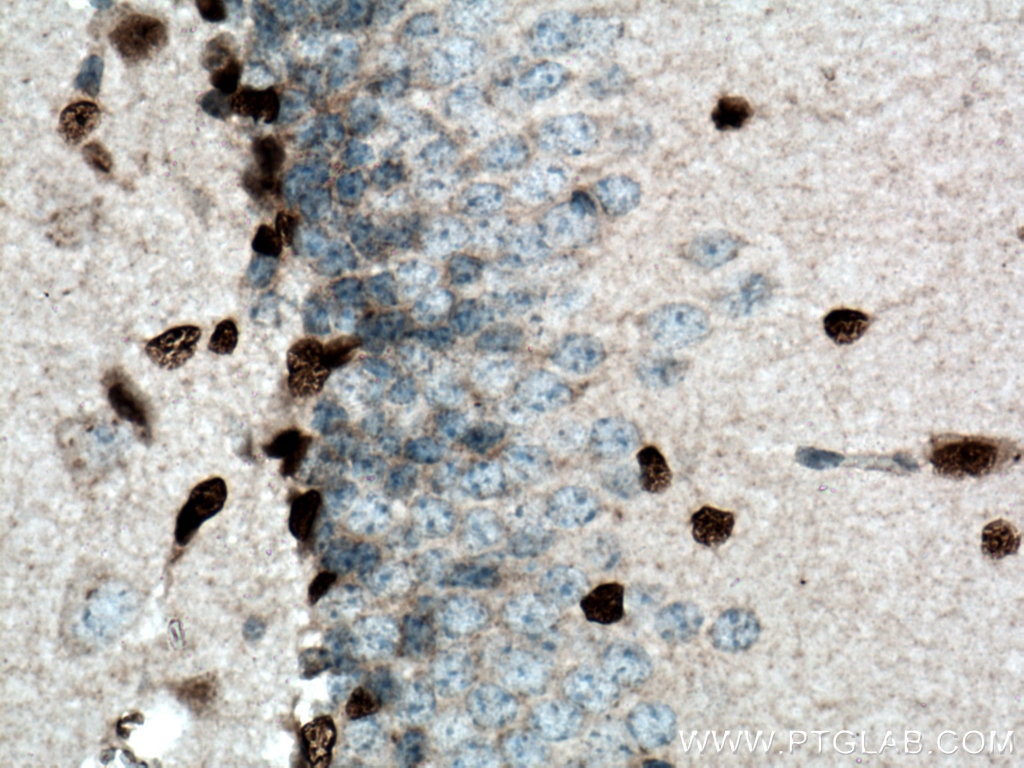 Immunohistochemistry (IHC) staining of mouse brain tissue using SOX2 Polyclonal antibody (11064-1-AP)